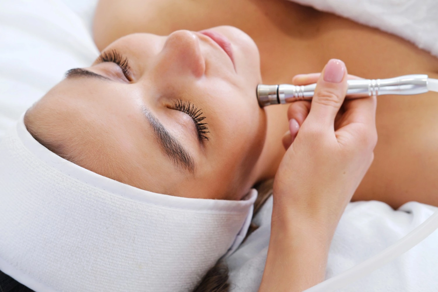 Microdermabrasion Facials for Acne Scars | Glow Beauty Bar