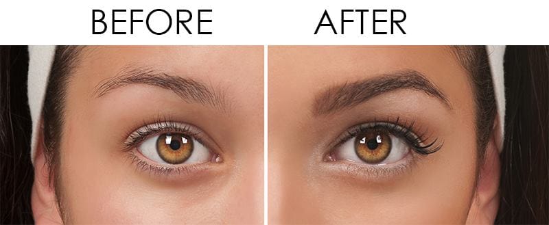 Before and After Signature PCA Skin Facial and Brow Wax and Tint Treatment result of Female | Glow Beauty Bar in Smyrna, GA