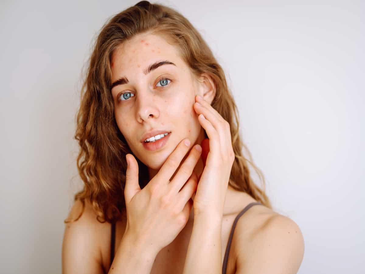 skin imperfection and lesion removal by glowbeautybaratlsmyrnaga